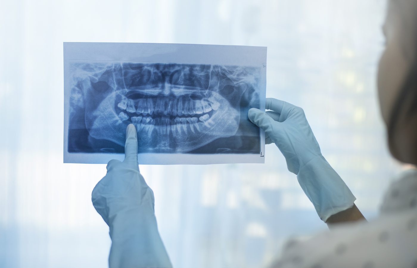 Dentist reviewing a dental x-ray