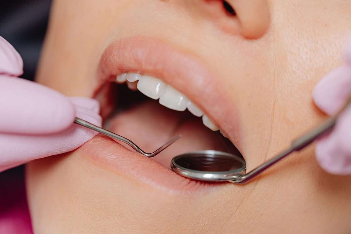Patient smiling after dental care